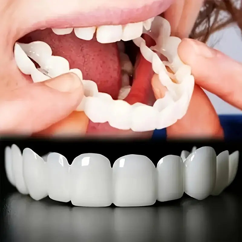 رياليستك عدسات الأسنان – طقم كامل (فك علوي وسفلي)، مظهر طبيعي وتبييض فوري